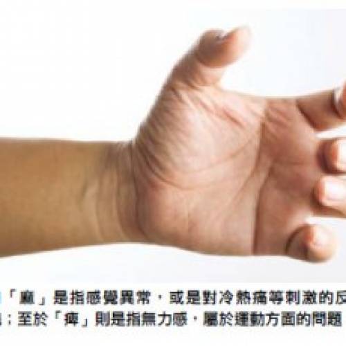 細談手脚麻痺背後的原因
