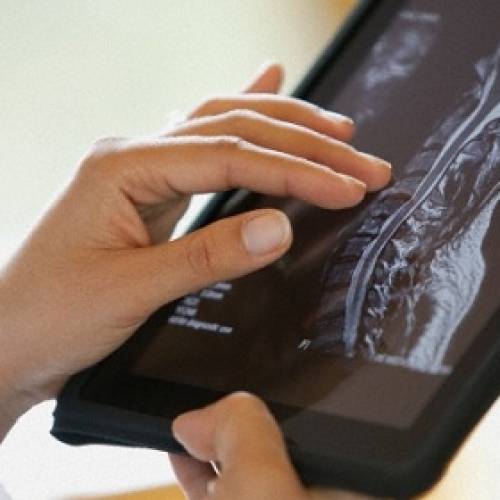 颈椎退化性脊髓病变（CSM）