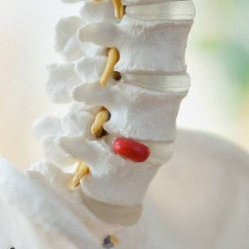 細箘感染性脊椎及椎間盤炎 (Septic Spondylodiscitis)